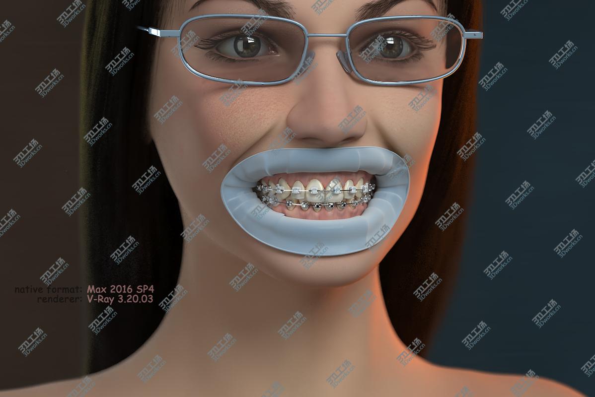 images/goods_img/2021040232/3D model Orthodontic Head (V-Ray)/2.jpg